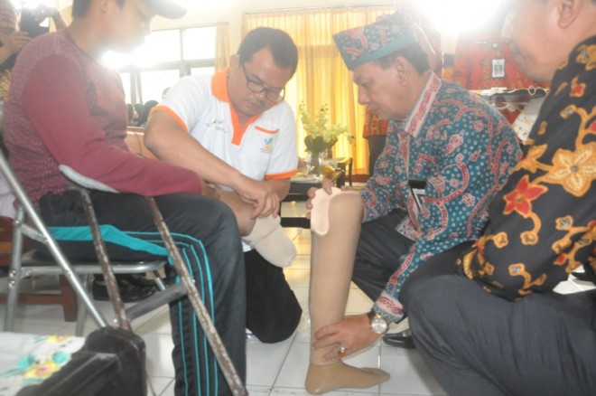Sekda saat memasang kaki palsu ke Disabilitas 