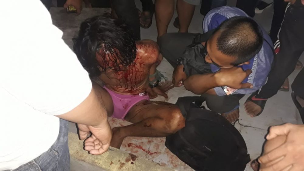 Kolor Ijo yang Babak Belur di Hajar Massa