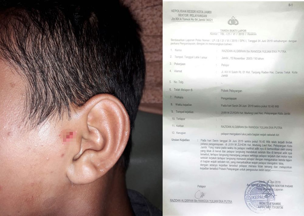 Telinga depan zidan yang terluka dan bukti laporan polisi.