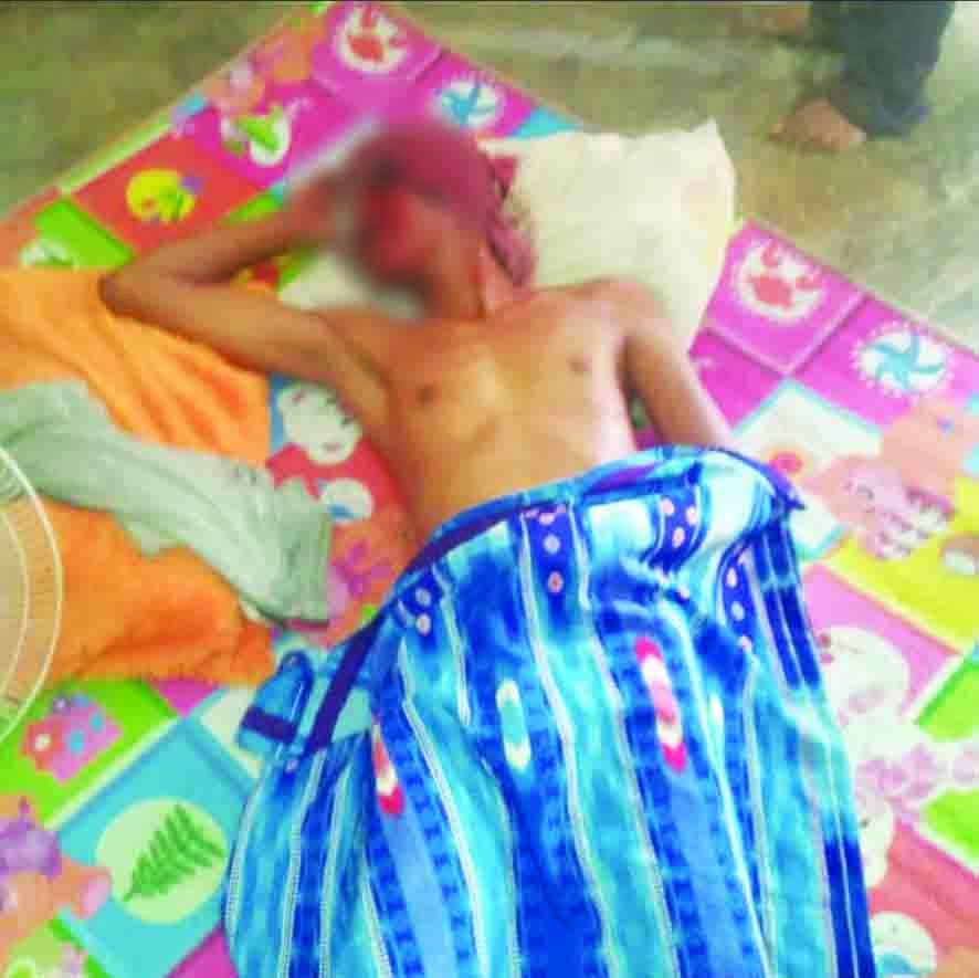 Safii terluka di serang beruang