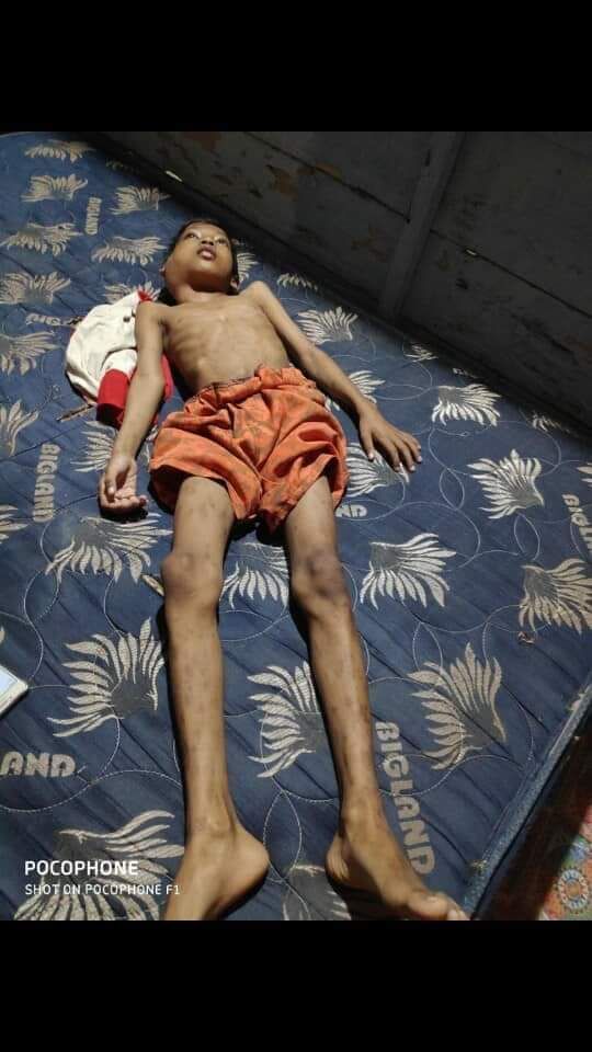 Eka Dani Saputra menderita tumor ganas stadium 4 .